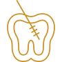 Endodoncia