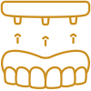 icono-implante-dental-carga-inmediata-