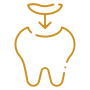 Incrustación Dental